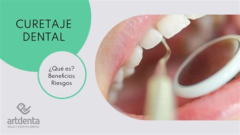 Curetaje dental Qué es Beneficios y riegos Clínica Dental en