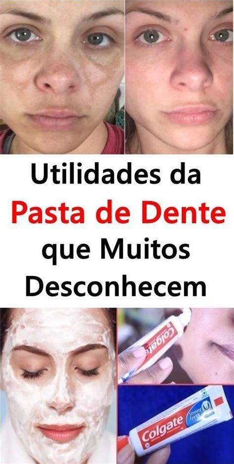 Utilidades Da Pasta De Dente Que Voc N O Conhece Sa De Em Fam Lia Em