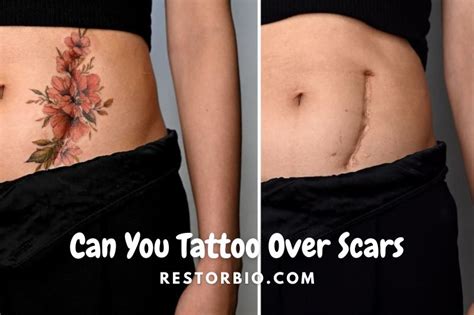 Can You Tattoo Over Scars What To Know Ideas Pain Levels 2022