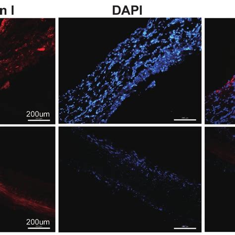 Collagen I Immunofluorescent Staining Of Frozen Section The Degree Of