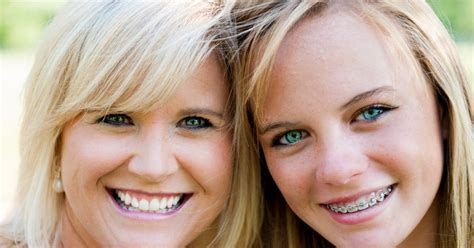 Advantages To Ceramic Braces Blue Ridge Orthodontics