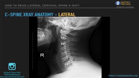 Cervical Spine X Ray Anatomy