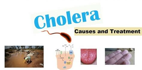 Cholera Causes Symptoms Treatment And Prevention