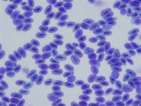 L14 A Blood Smear From A Saker Falcon Showing Agyptinella Sp