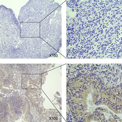 Ecrg Suppresses Npc Cell Proliferation And Colony Formation A Western