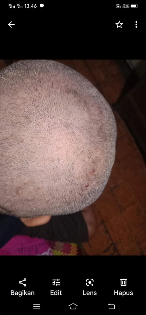 penyakit kulit - HelloSehat