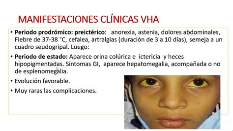 Sintomas De Hepatitis B En Ni Os