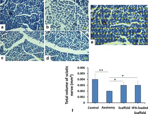 Ad Micrograph Of The Sciatic Nerve Stained With Luxol Fast Blue Lfb