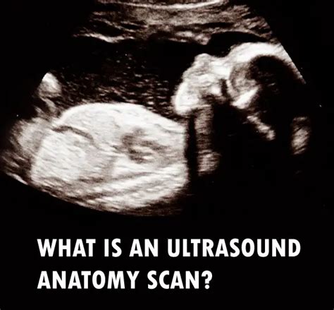 Ultrasound Anatomy Scan: Uses, Timing and Importance - 3DBiology.com