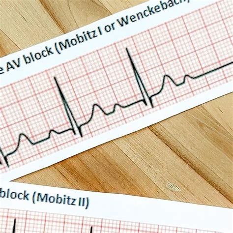 Kristine Tuttle On Instagram Lets Talk About HEART BLOCKS There