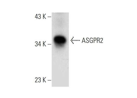 ASGPR2 Asialoglycoprotein Receptor 2 ASGR2抗体 B 4 SCBT Santa Cruz