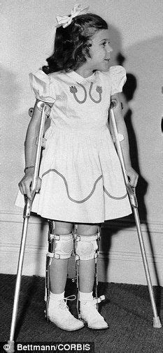 Pin By Dianne Dych On Polio 3 Polio Leg Braces Fashion Photography