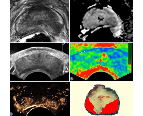 Multiparametric Ultrasound And Mri Modalities Top Left And Right Download Scientific Diagram