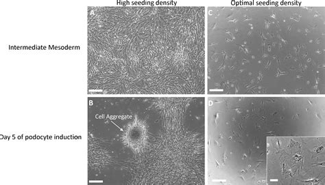 Guided Differentiation Of Mature Kidney Podocytes From Human Induced