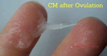 Cervical Mucus After Ovulation & If Pregnant: Is It Creamy, Egg White ...