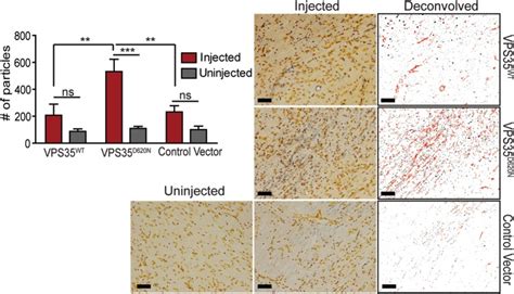 Nigral Axonal Degeneration Induced By Aav Mediated Expression Of