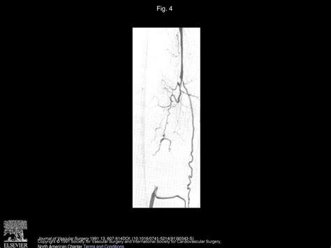 Excimer Laser—assisted Femoral Angioplasty Early Results Ppt Download