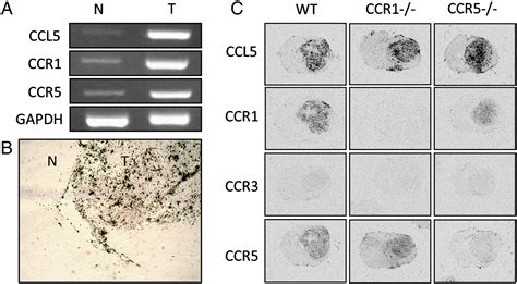 Ccl5 Ccr1 And Ccr5 In Murine Glioblastoma Immune Cell Infiltration