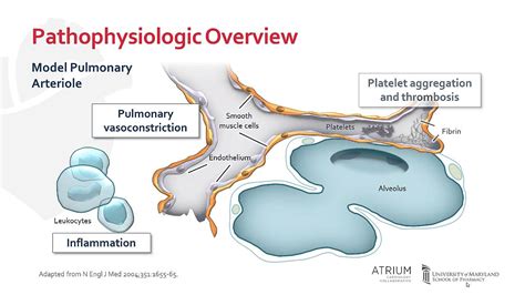 Pathophysiology Of Pulmonary Arterial Hypertension Youtube