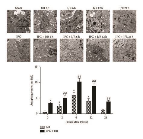 Autophagy Induction During Ischemiareoxygenation Ir Injury In Rats