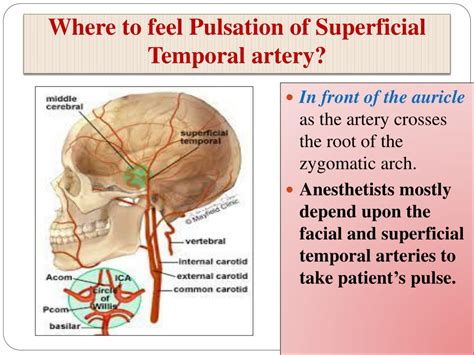 Superficial Temporal Arteries