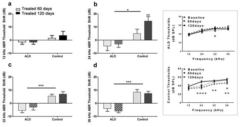 Age Related Hearing Loss Prevention Of Threshold Declines Cell Loss