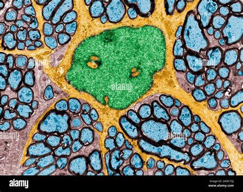 False Colour Transmission Electron Micrograph Tem Showing A Fibrous