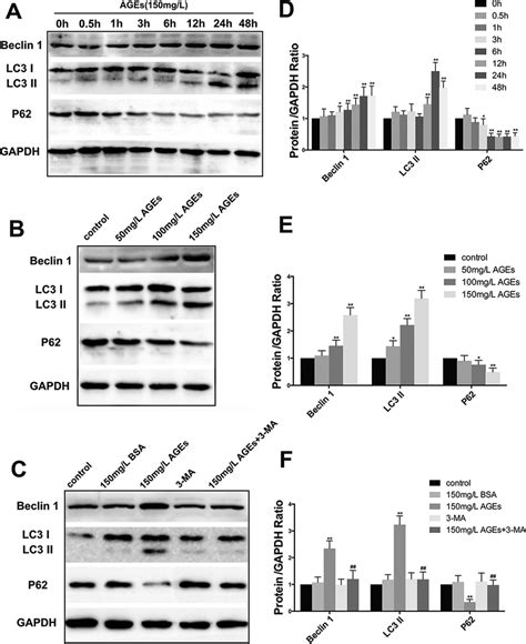 Effect Of AGE BSA On The Expression Of Autophagy Related Protein