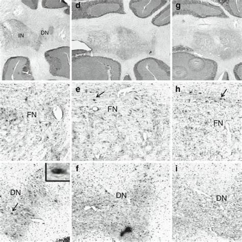 Representative Low Power Photomicrographs Of C Fos Expression In A