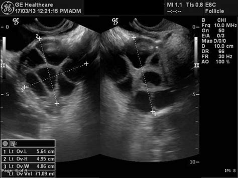 383 best images about OB/Gyn Ultrasound 101 Mod 2 on Pinterest ...