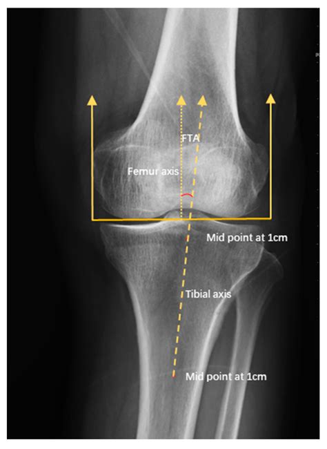 Applied Sciences Free Full Text Association Between Proximal