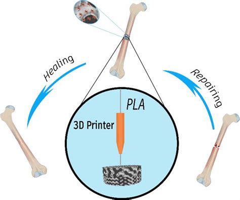 schematic shape   scaffold based approach   bone