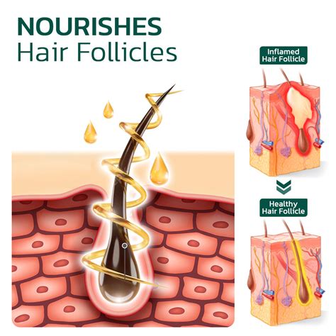 GFOUK™ Scalp Folliculitis Therapy Oil – G-FOUK