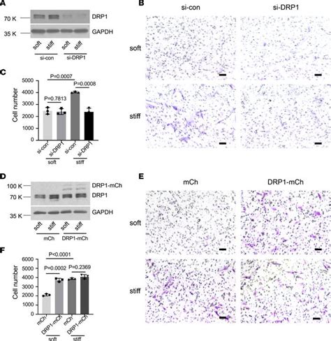 Jci Insight Mitochondrial Fission And Bioenergetics Mediate Human