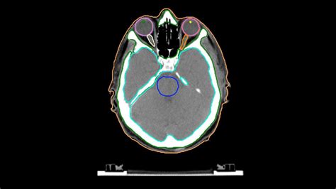 Ai Rad Companion Organs Rt