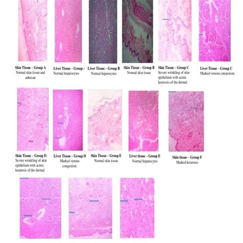 Representative Photomicrograph X 100 Magnifications Of The Skin And Download Scientific