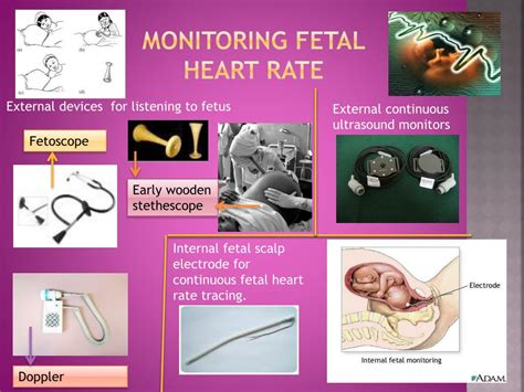 Fetal Heart Rate Monitoring