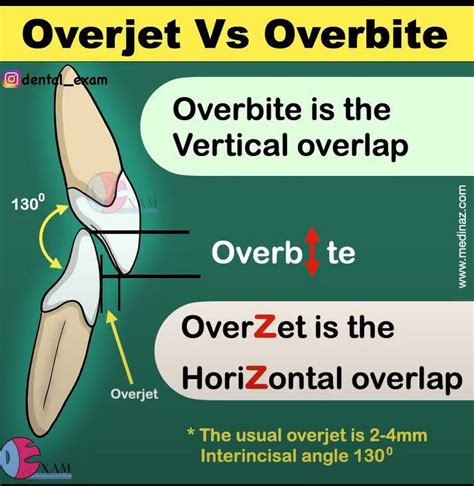 Overjet Vs Overbite Medizzy