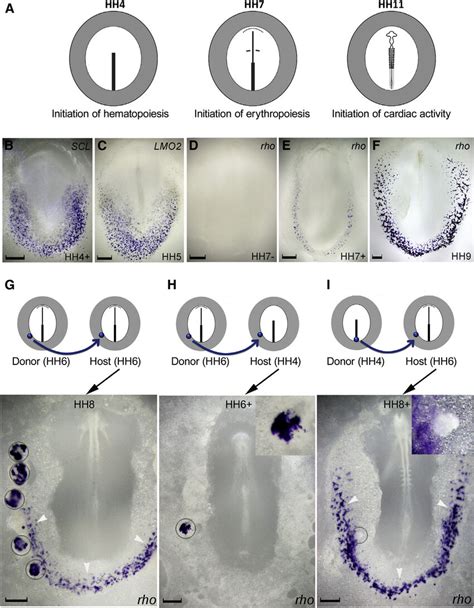 Developmental Delay From Hematopoiesis To Erythropoiesis And