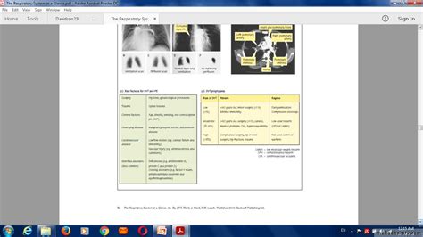 Pulmonary Vascular Disease Pptx D Majeed Muhadharaty