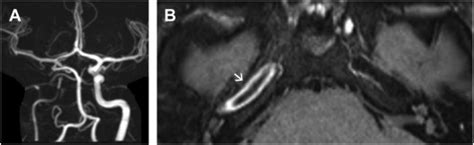 The Use Of Intracranial Vessel Wall Imaging In Clinical Practice