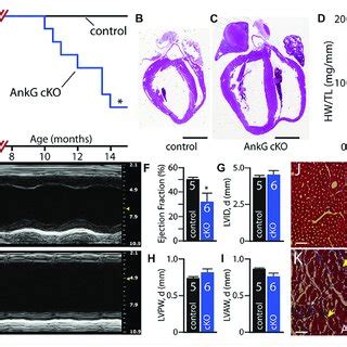 AnkG CKO Mice Display Increased Ventricular Dysfunction With Age