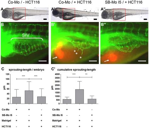 Tumor Angiogenesis Is Abolished In Pkd Morphant Tg Fli Egfp