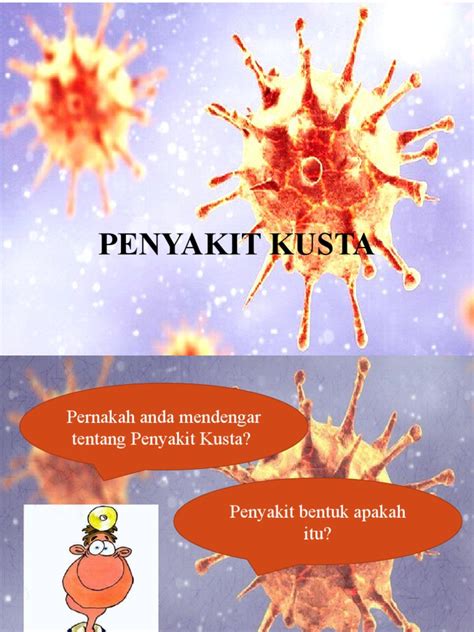 Penyuluhan Penyakit Kusta 1 Pdf