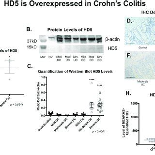 Aberrantly Expressed Of HD5 In IBD A Transcript Levels Of HD5 In