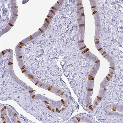 Immunohistochemical Staining Of Human Fallopian Tube Shows Distinct