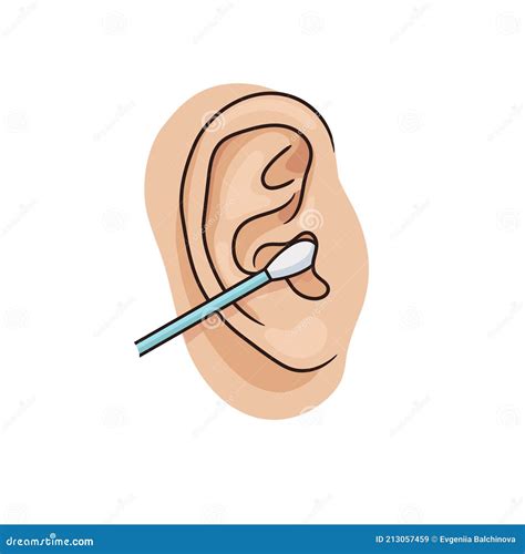 Cleaning the Ear Canal with a Cotton Swab. Illustration of Unhealthy ...