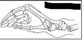 Upper Limb Iii Wrist And Hand Flashcards Quizlet