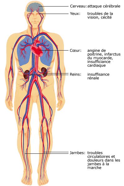 Lhypertension Artérielle Ccjj Centre Cardiovasculaire Jean Jaurès