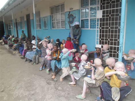 Fearful Albino Children in Africa Receive Outreach Program Meals - The ...